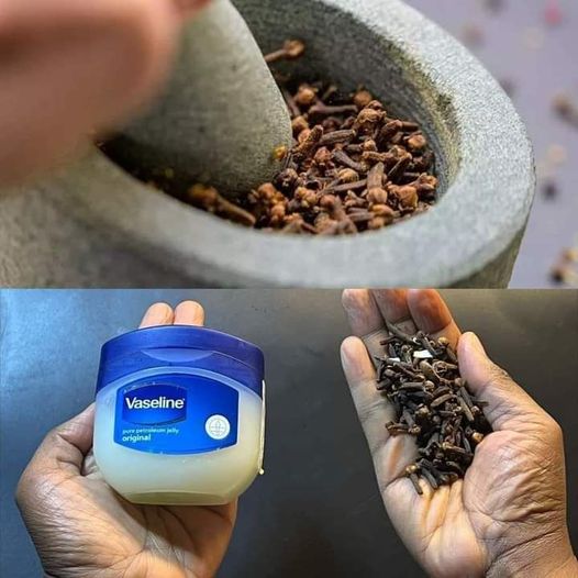 Unlock the Power of Cloves and Vaseline: A Game-Changing Remedy You Need to Try