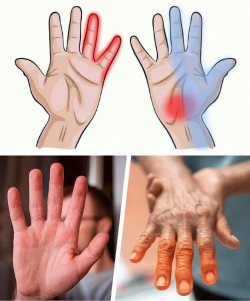 7 Health Warning Signs Your Hands Can Reveal